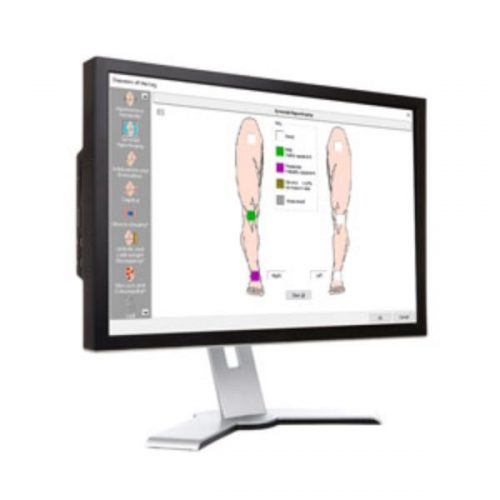 Lower Extremity Evaluation and Impairment Calculation Software