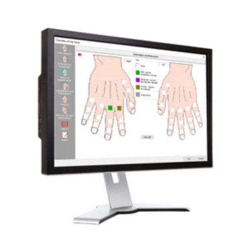 Upper Extremity Evaluation Software