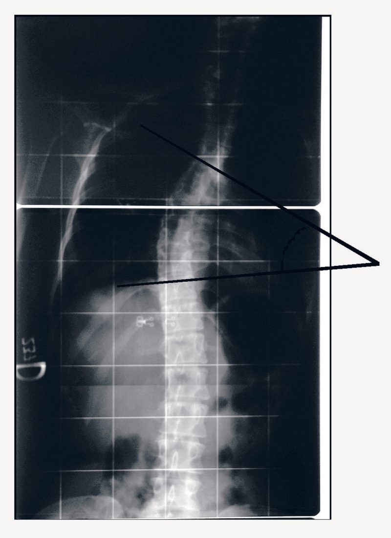 D’ Osualdo Inclinometer (06855) - Image 6