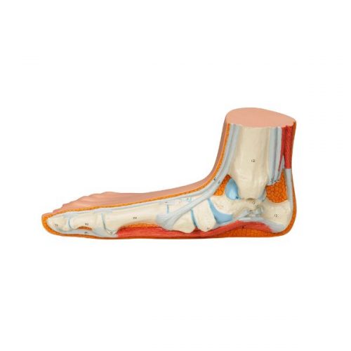 Flat Foot (M31)